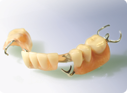 New Brunswick Dentist Partial Denture