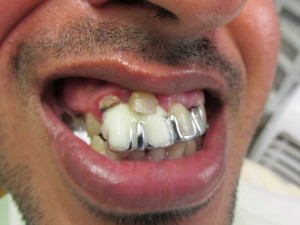 Dentista Hispana New Brunswick