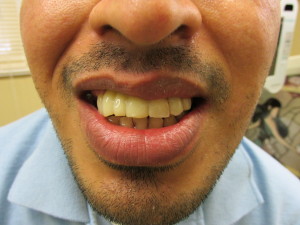 Dentista Hispana en New Brunswick