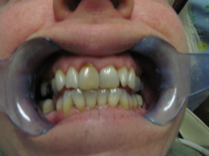 Cosmetic Dentist New Brunswick